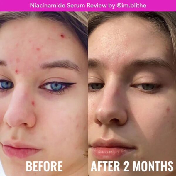 Good Molecules Niacinamide Serum 75ml