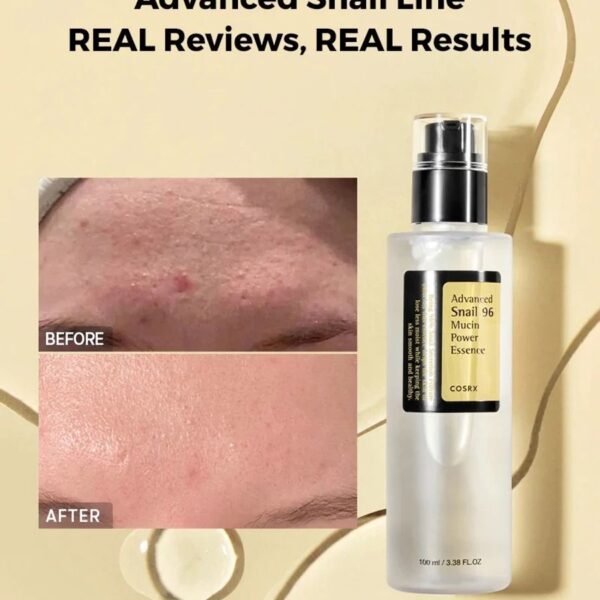 COSRX Advanced Snail 96 Mucin Power Essence 100ml