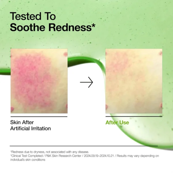 Anua – Azelaic Acid 10 Hyaluron Redness Soothing Serum 30ml
